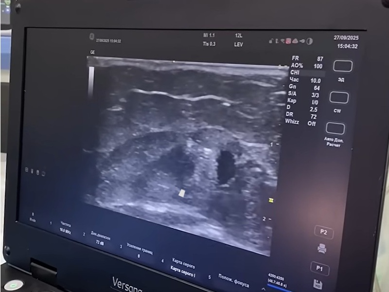 Сосудистая хирургия Сосудистая хирургия