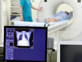 Пневмофиброз