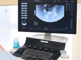 Полікістоз яєчників