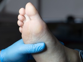 Пяточная шпора