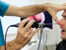 Радиоволновая коагуляция нижних носовых раковин