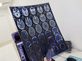 Рентген гайморовых пазух