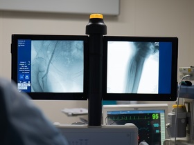 Стентування коронарних артерій