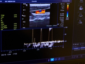 УЗИ мягких тканей